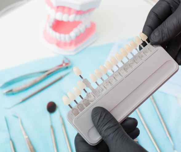 Dentist checking tooth shade comparison chart